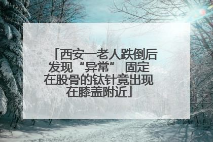 西安一老人跌倒后发现“异常” 固定在股骨的钛针竟出现在膝盖附近